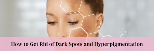 How to Get Rid of Dark Spots and Hyperpigmentation