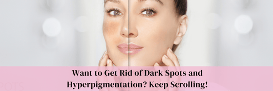 Want to Get Rid of Dark Spots and Hyperpigmentation? Keep Scrolling!
