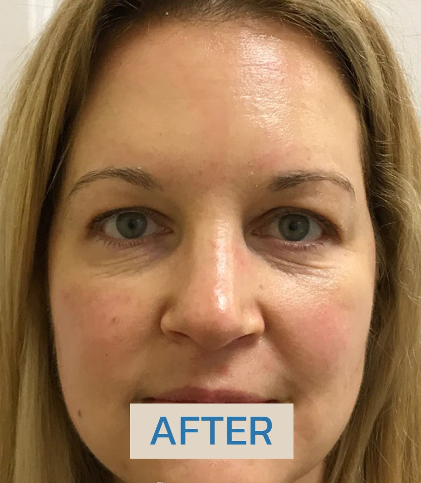 https://skinglo.co/cdn/shop/files/b2_1_5b763a36-43fd-42c3-8343-fe418635d9dc.jpg?v=1722702562 Bio-collagen Real Deep Mask