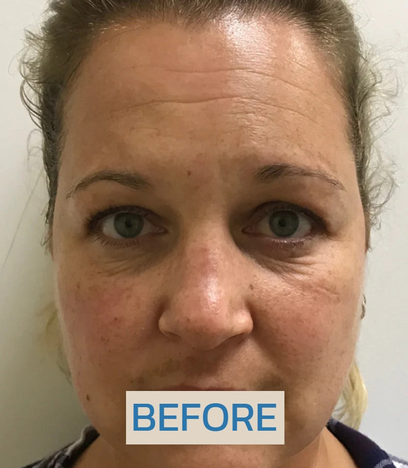 https://skinglo.co/cdn/shop/files/b2_9565893e-4ac4-478e-8eb2-333db1823b3f.jpg?v=1722702562 Bio-collagen Real Deep Mask